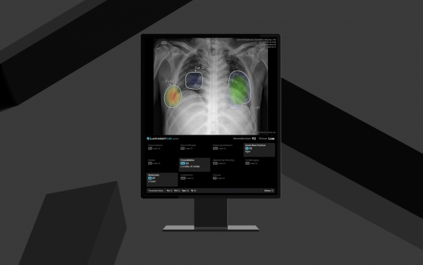 ▲Lunit INSIGHT CXR4