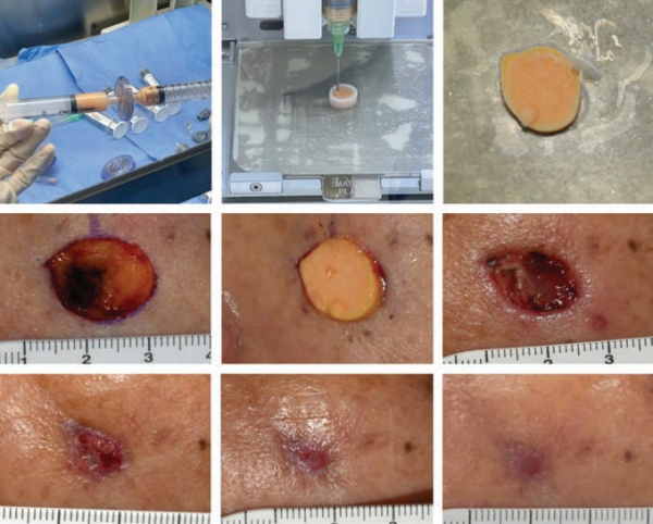 ▲로킷헬스케어, 美 성형외과학회서 피부암 플랫폼 공식 소개